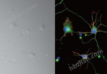 奧林巴斯顯微鏡